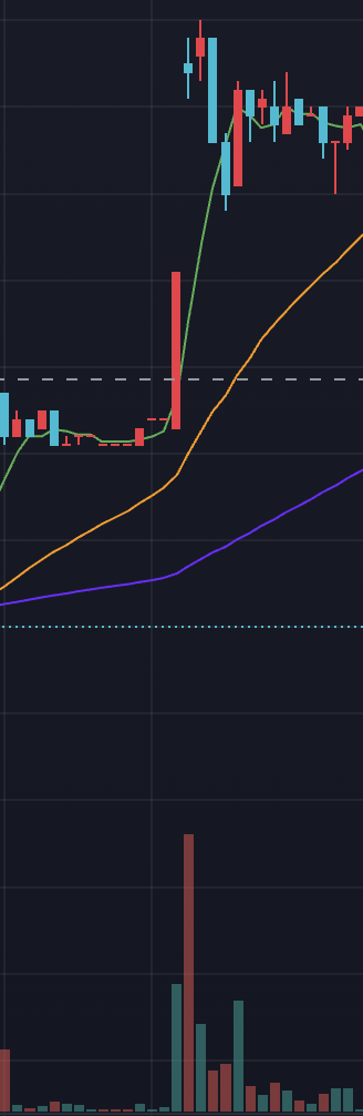 逆V戦略の5分足